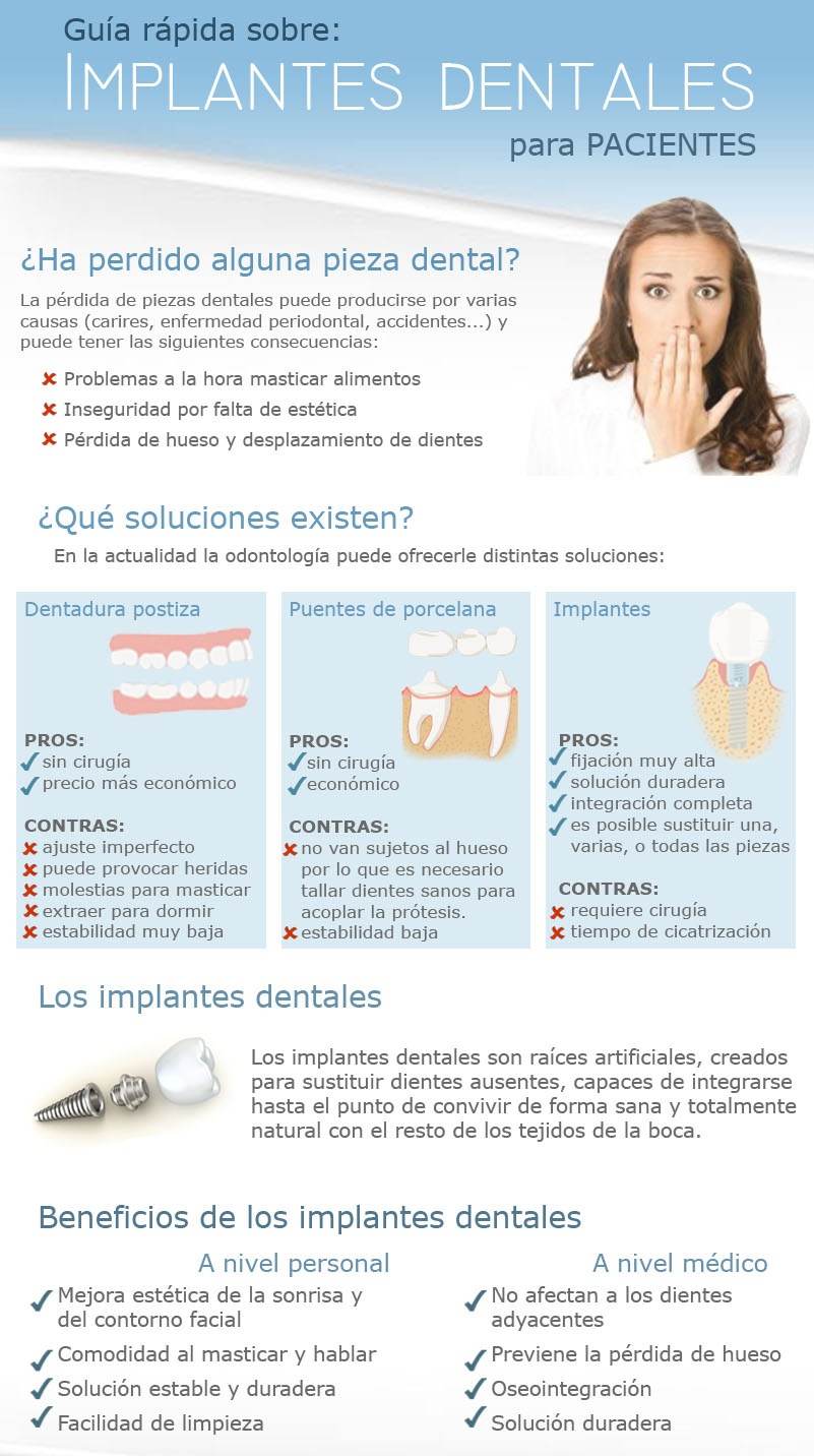 Implantes_dentales_para_pacientes.jpg